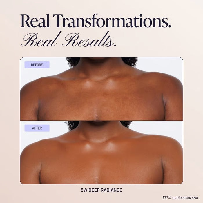 🔥Last Day 49% OFF🔥Body Coverage perfector